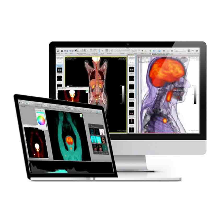 OsiriX MD 64-bit PL wersja medyczna