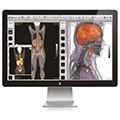 OsiriX