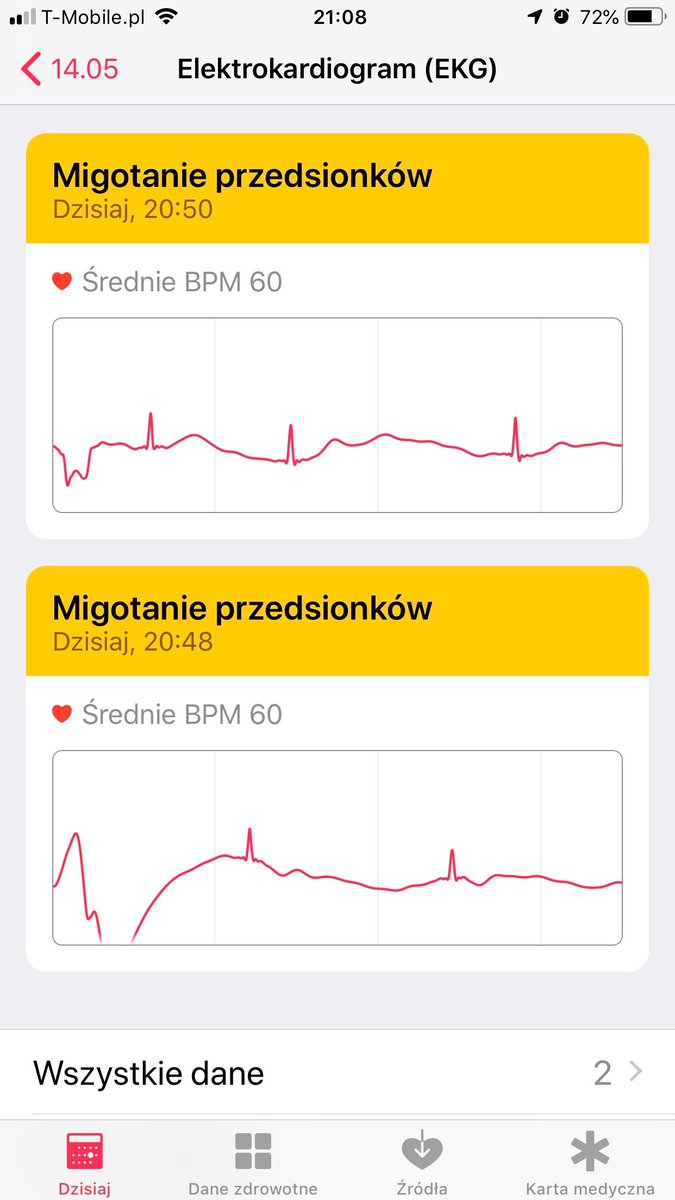 Apple-Watch-migotanie-przedsionków